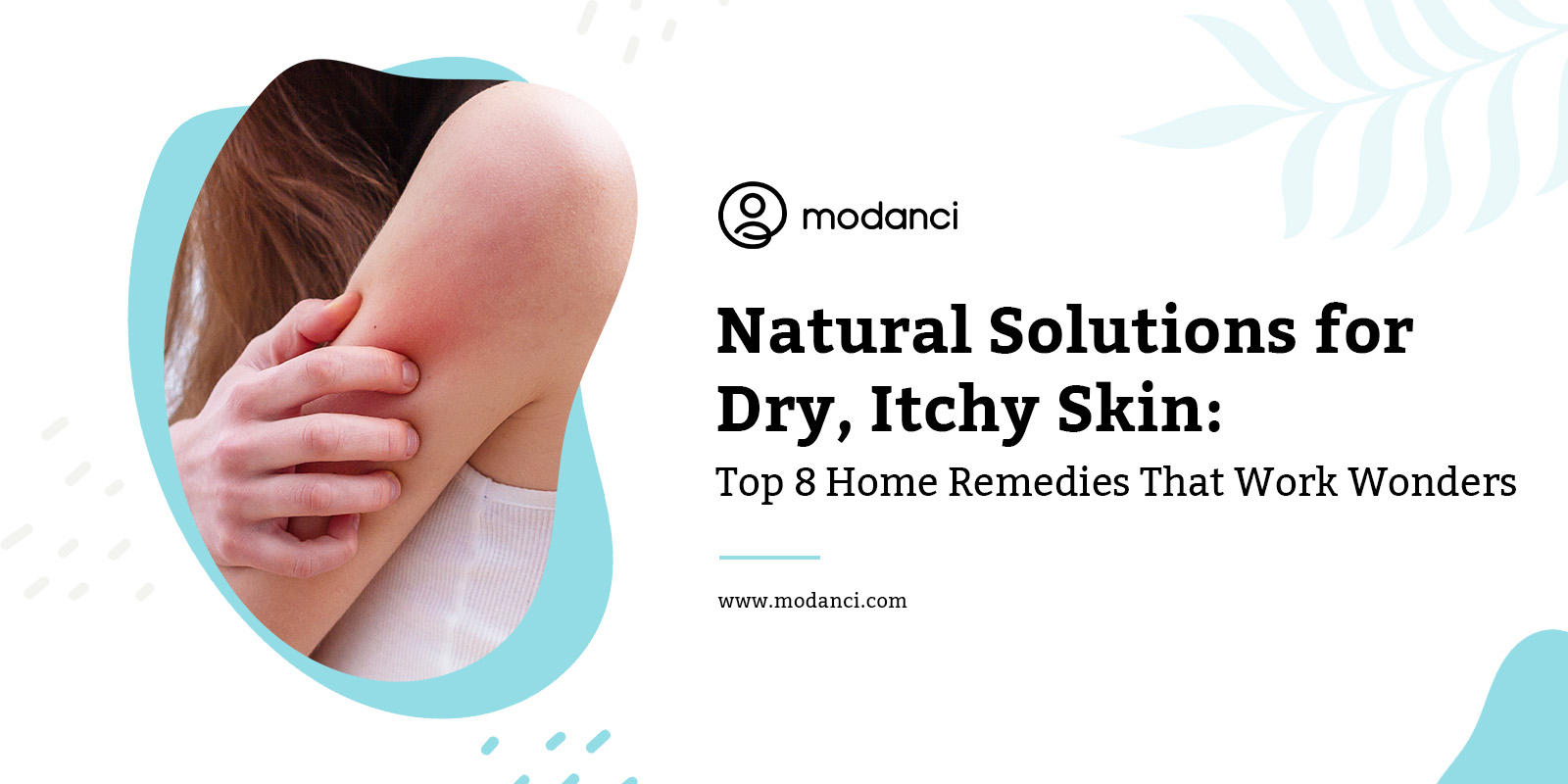 home remedies for itchy skin