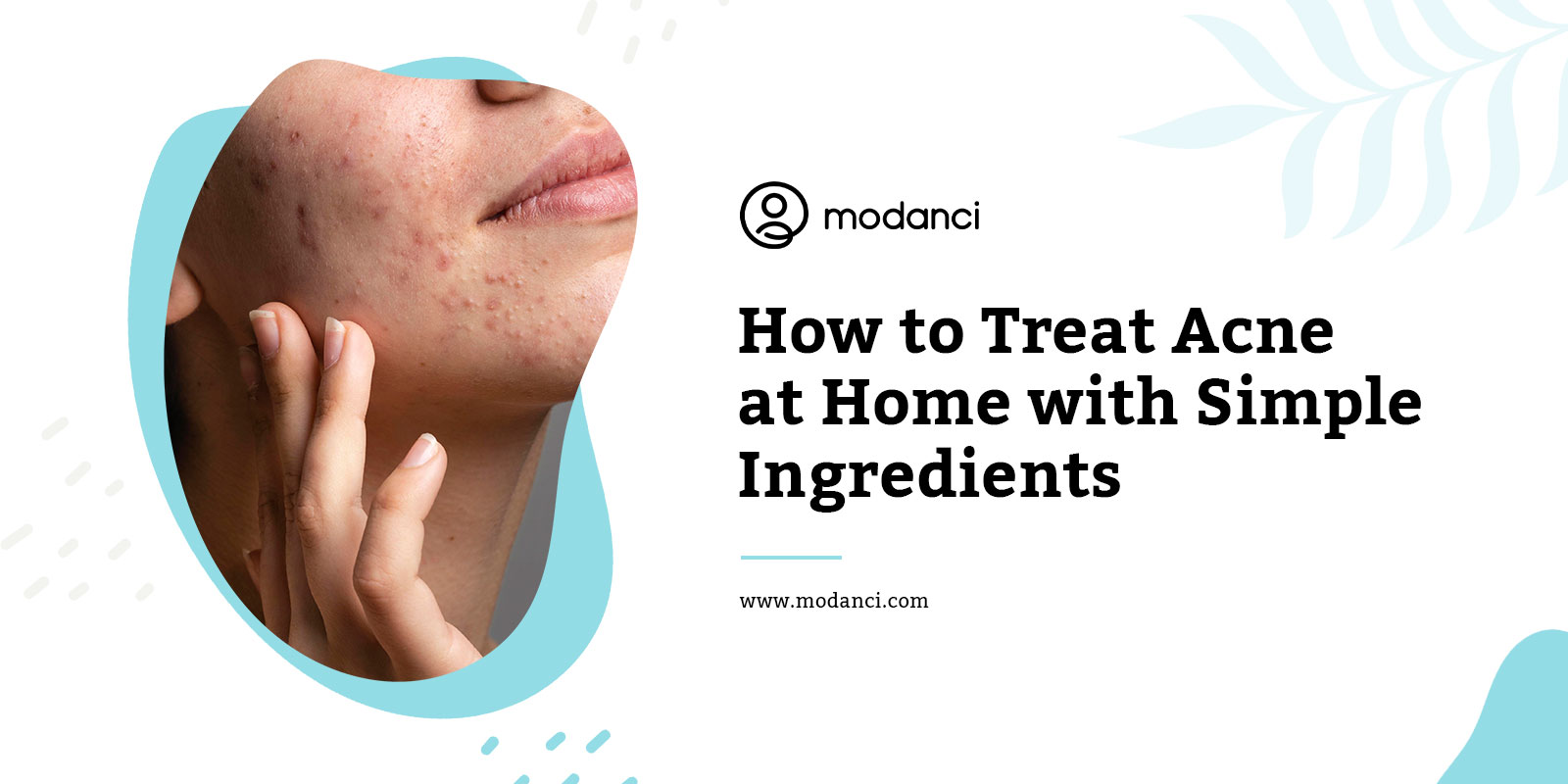 treat-acne-at-home