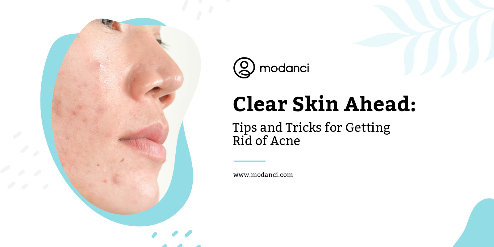 getting rid of acne
