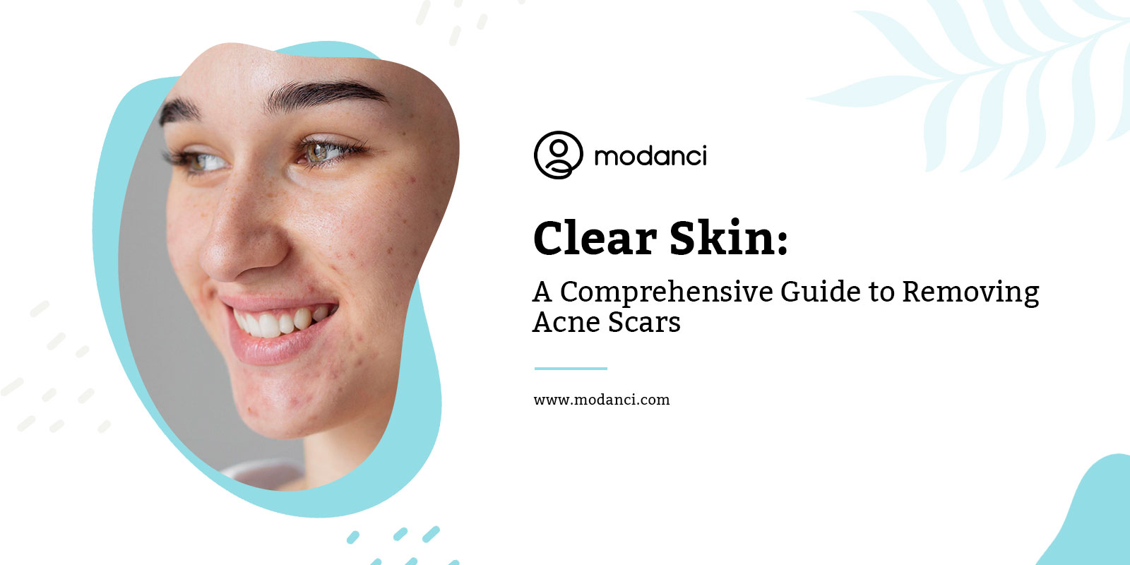 removing acne scars