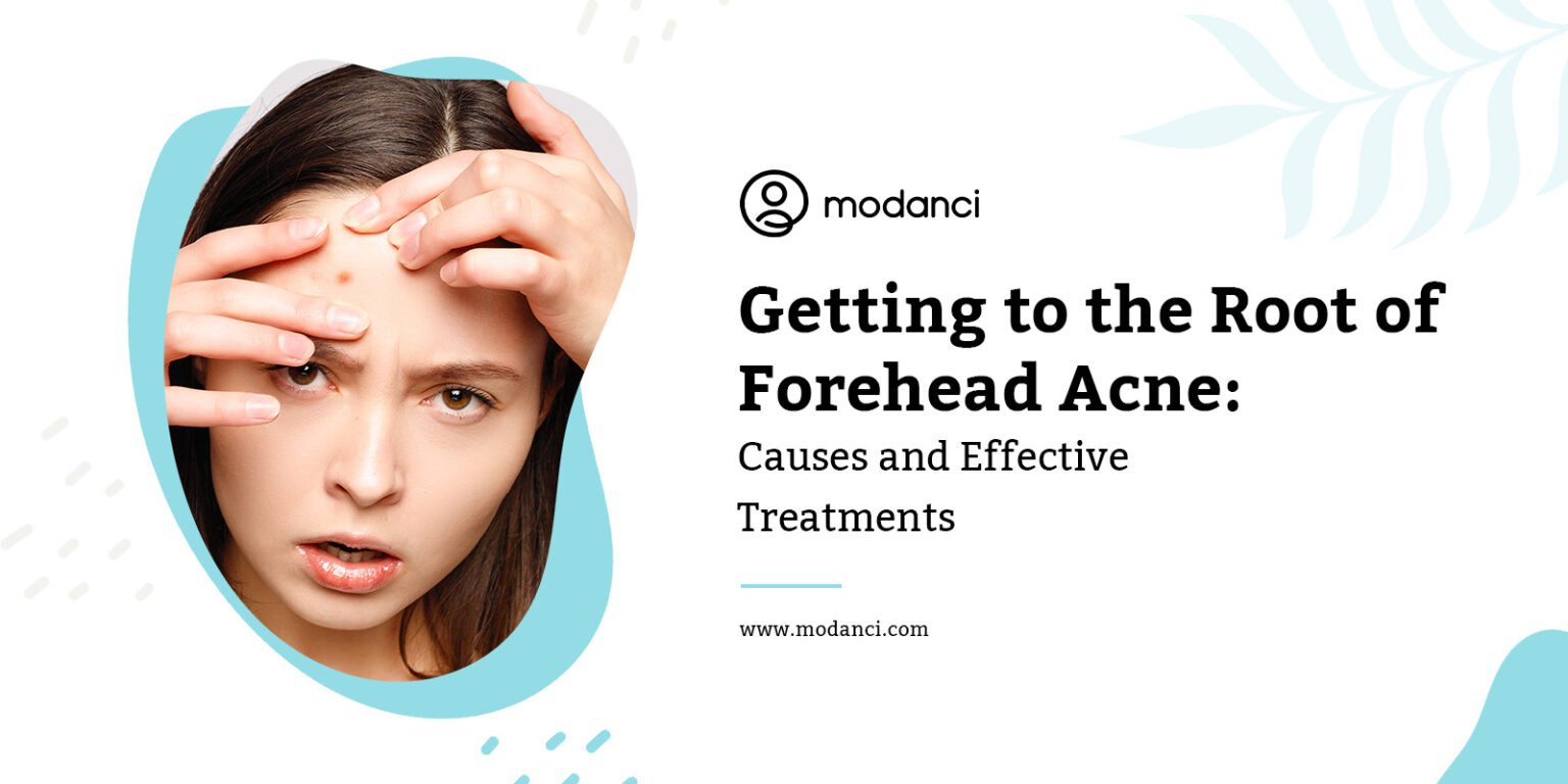 Getting To The Root Of Forehead Acne Causes And Effective Treatments Modanci 5531