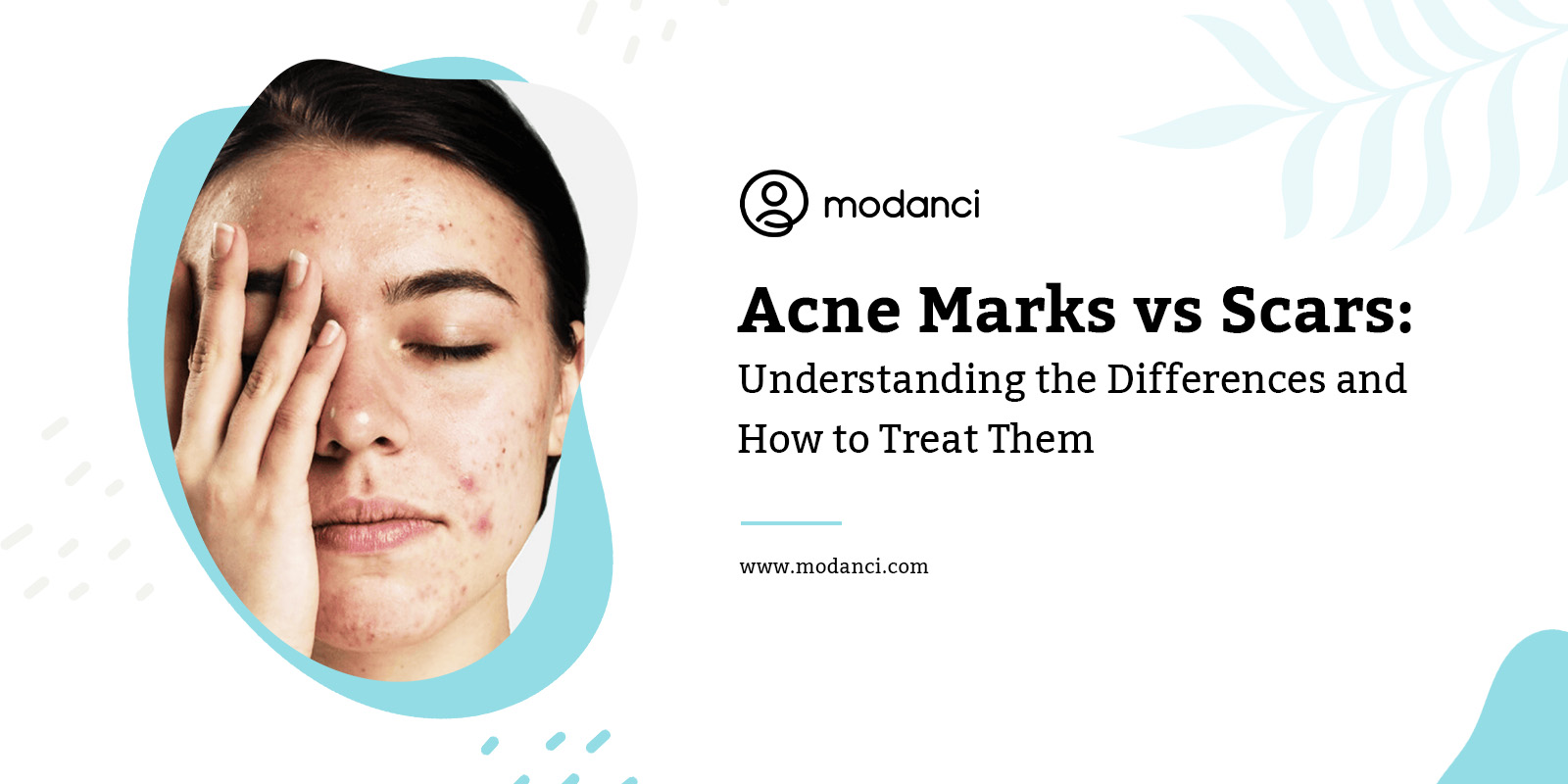 acne marks vs scars