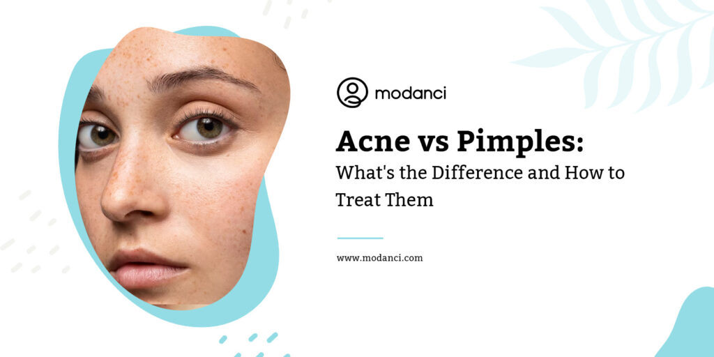 Acne Vs Pimples What S The Difference And How To Treat Them Modanci